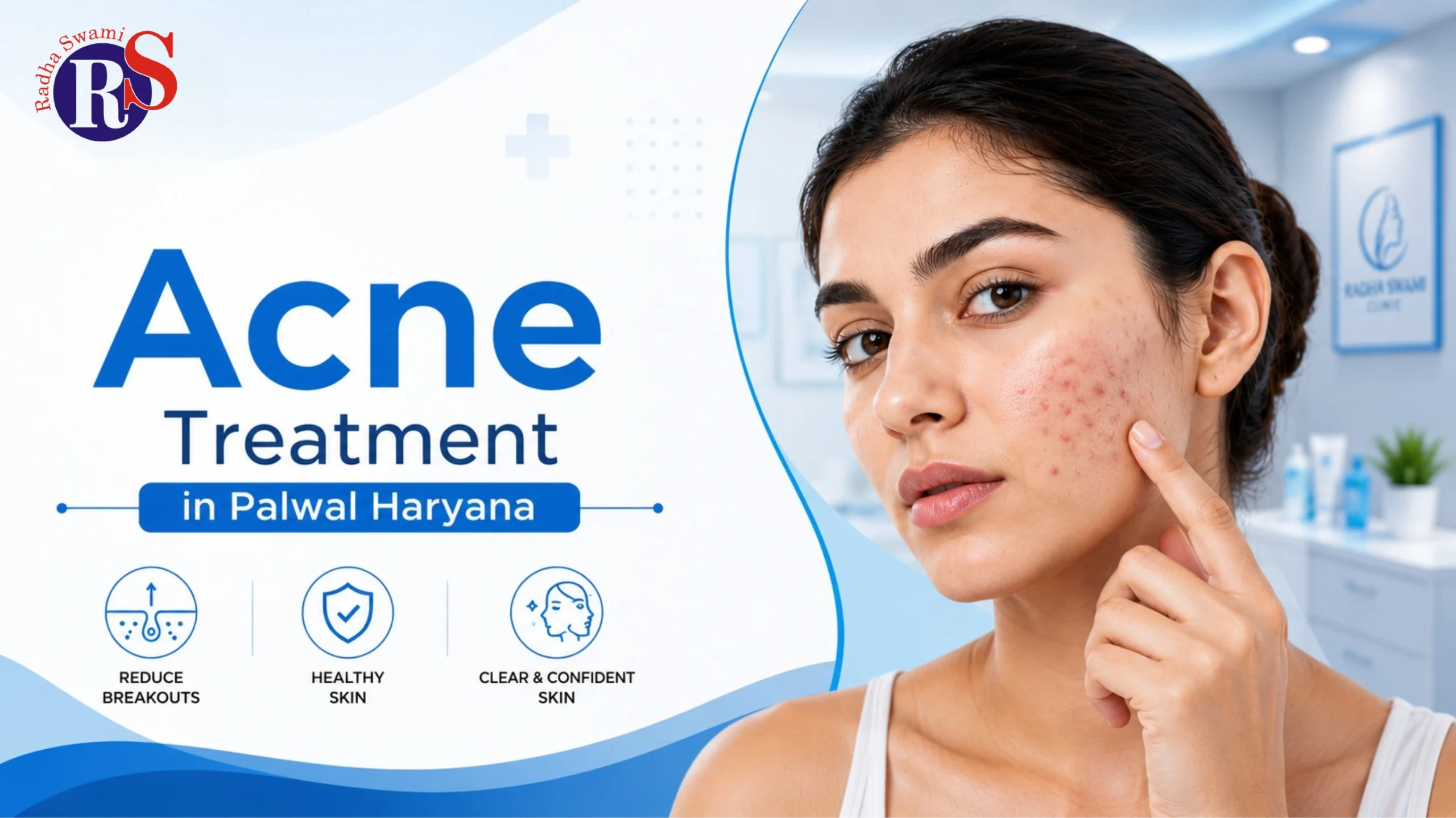 Acne Treatment in Palwal Haryana: Causes and Solutions